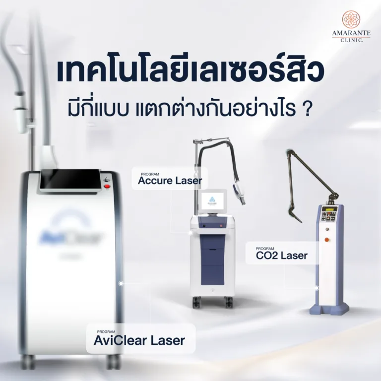 เลเซอร์สิวมีกี่แบบ