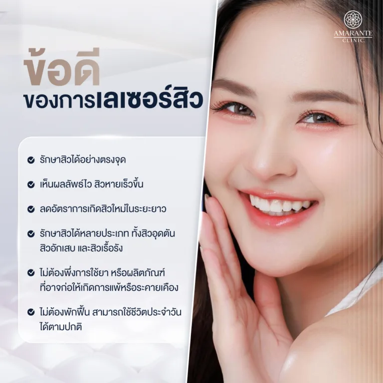 ข้อดีของการเลเซอร์สิว