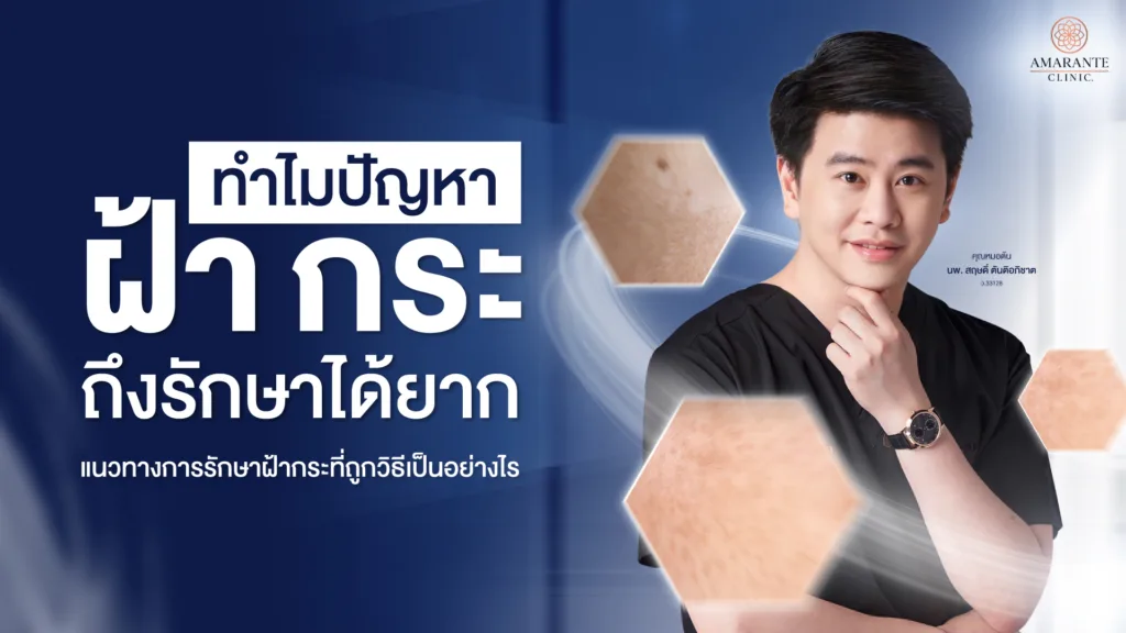 วิธีรักษาฝ้า