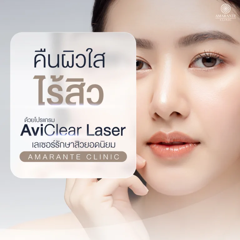 AviClear เลเซอร์รักษาสิว ที่ Amarante clinic