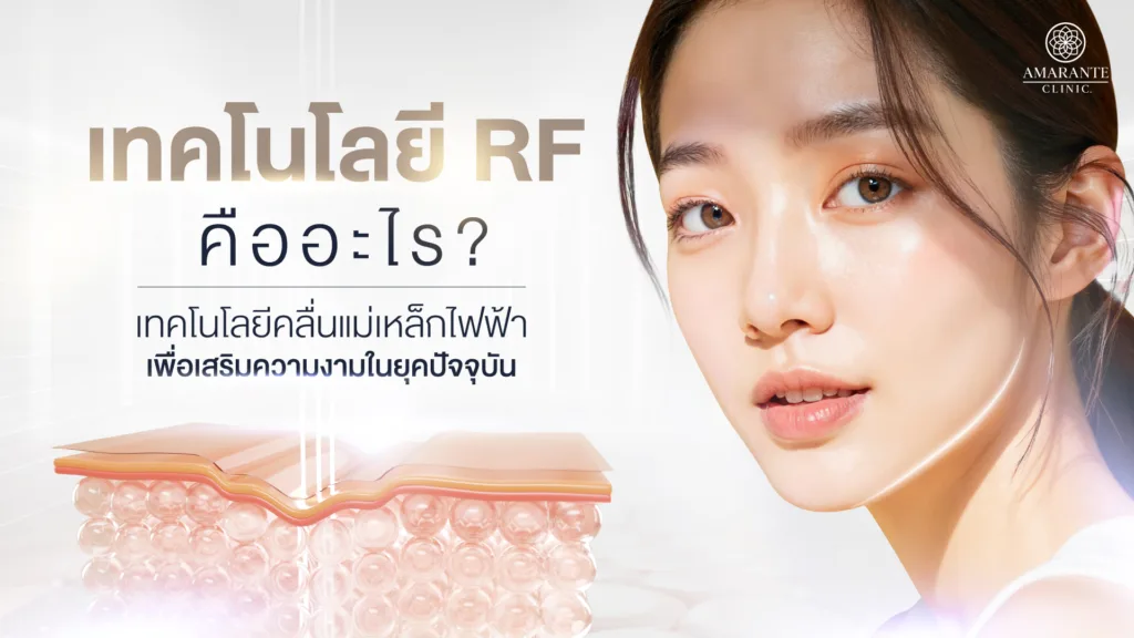 RF คืออะไร