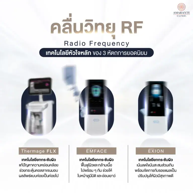 เครื่อง Radio Frequency หรือ RF