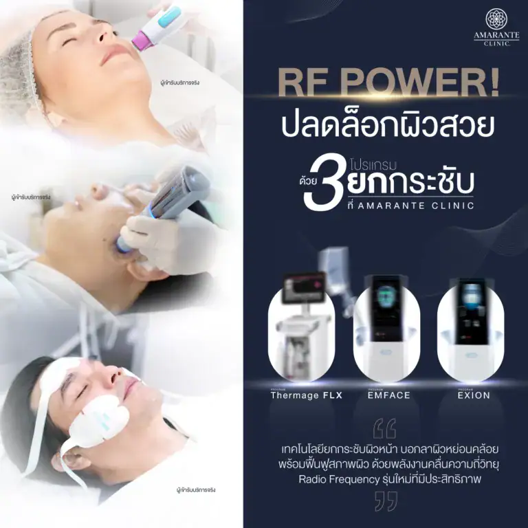 Radio Frequency หรือ RF ที่Amarante