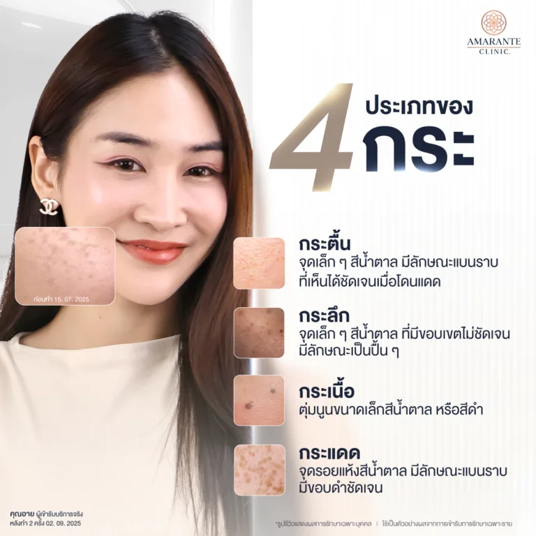 กระมีกี่ประเภท