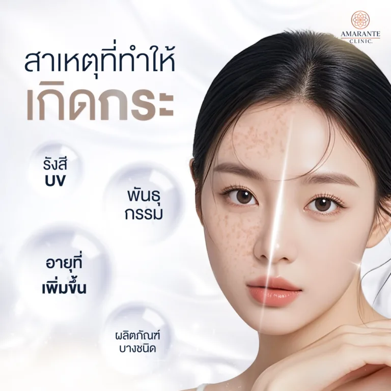 สาเหตุไหนบ้างที่ทำให้เกิดกระ
