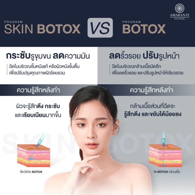 ความแตกต่าง Skin Botox กับ Botox ทั่วไป