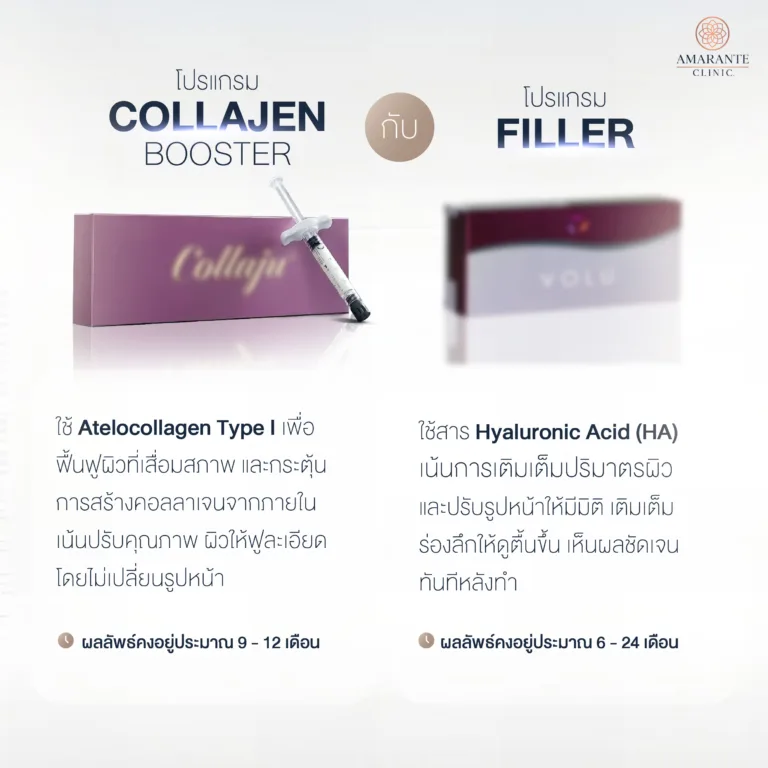 Collaju กับ ฟิลเลอร์ต่างกันอย่างไร