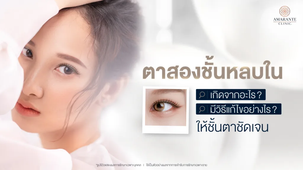 ตาสองชั้นหลบในเกิดจากอะไร แก้ไขได้อย่างไร