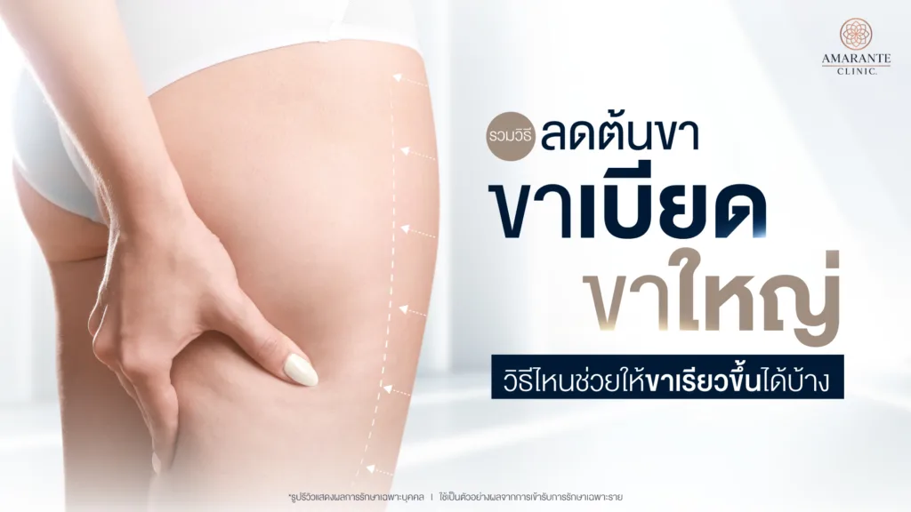 วิธีลดต้นขา ขาเบียด ขาใหญ่ วิธีไหนช่วยให้ขาเรียวขึ้น