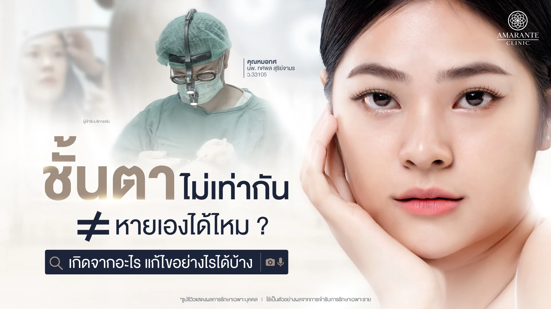 ชั้นตาไม่เท่ากันหายเองได้ไหม แก้ไขอย่างไรได้บ้าง