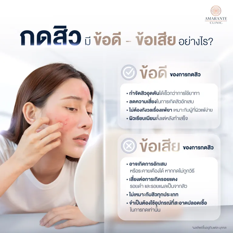 กดสิว ข้อดี ข้อเสีย