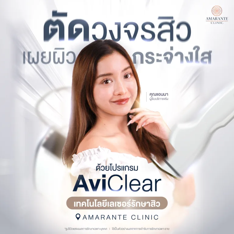 เป็นสิวรักษาด้วยโปรแกรม AviClear ที่ Amarante Clinic