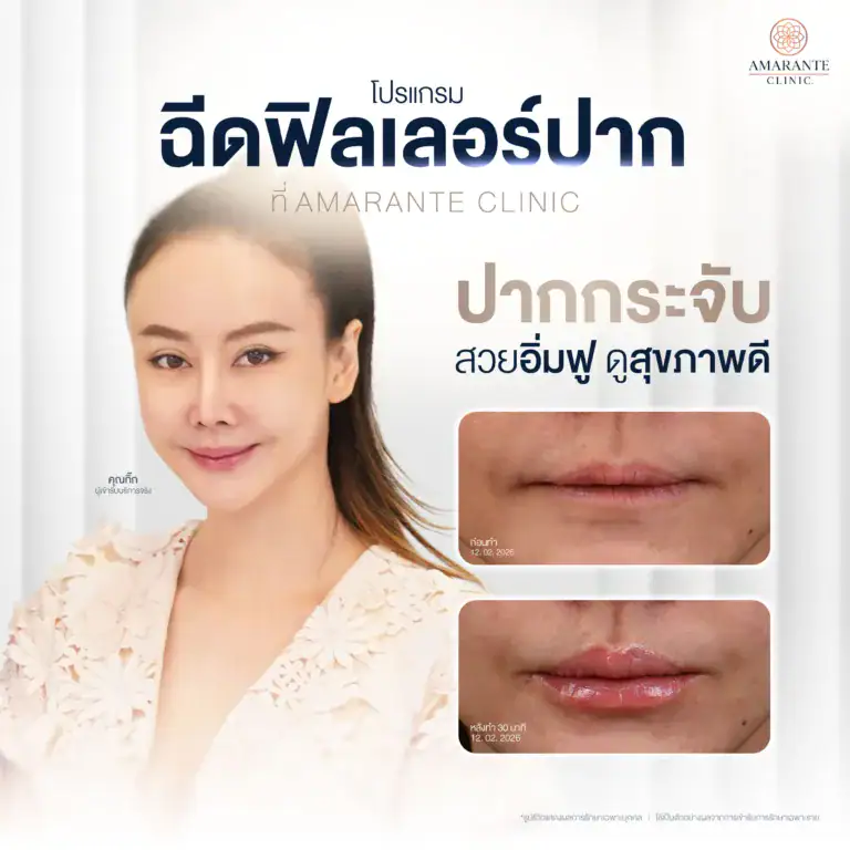 โปรแกรมฟิลเลอร์ปาก ที่ Amarante Clinic