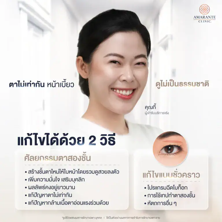 วิธีแก้ไขตาไม่เท่ากัน
