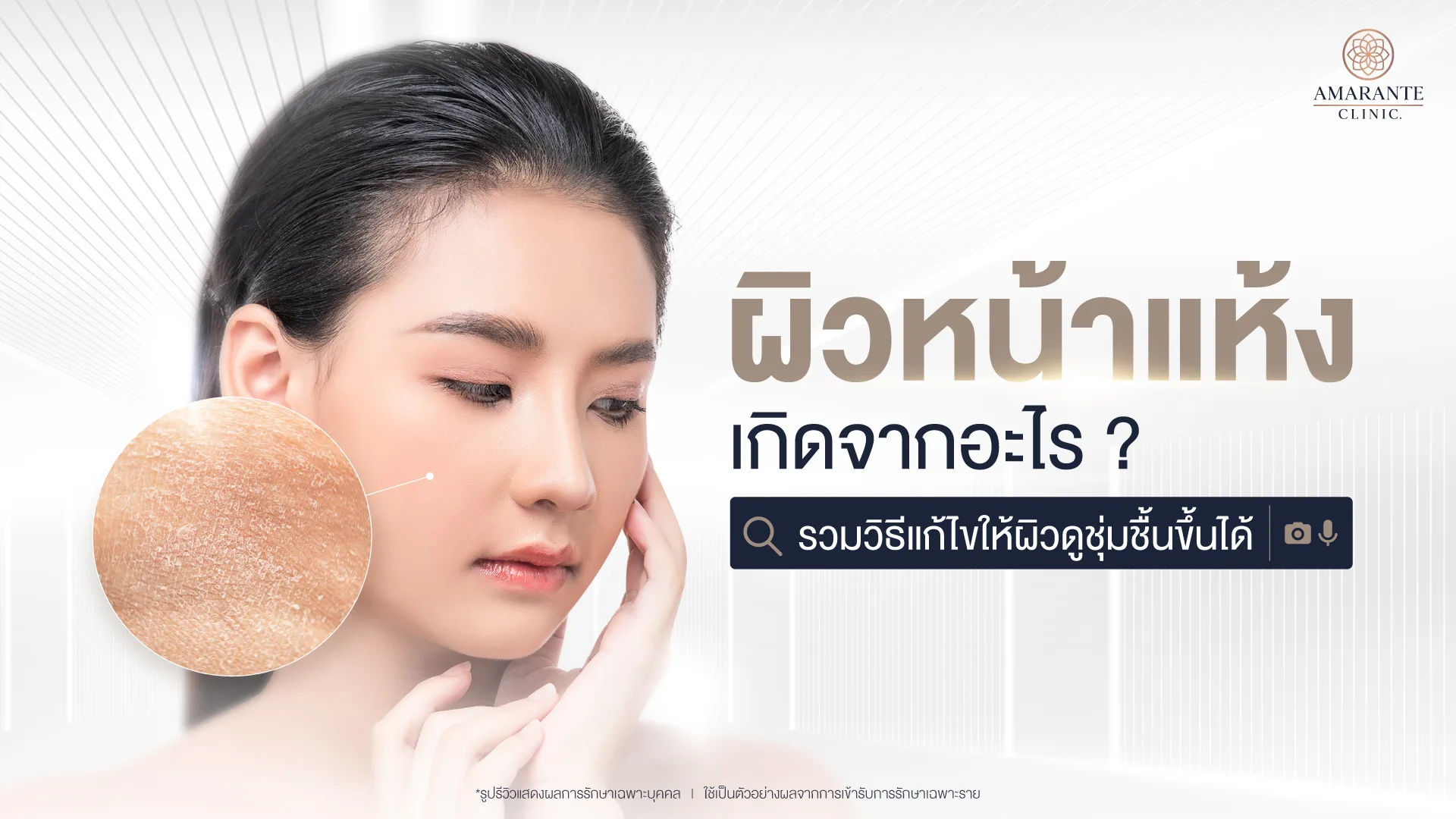 ผิวหน้าแห้ง เกิดจากอะไร? รวมวิธีแก้ไขให้ผิวดูชุ่มชื้นขึ้นได้
