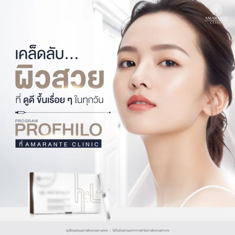 โปรแกรม Profhilo ที่ Amarante Clinic