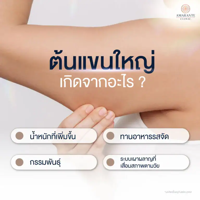 แขนใหญ่เกิดจากอะไร
