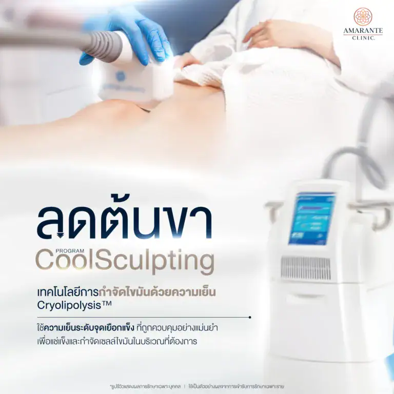 วิธีลดต้นขาด้วย CoolSculpting