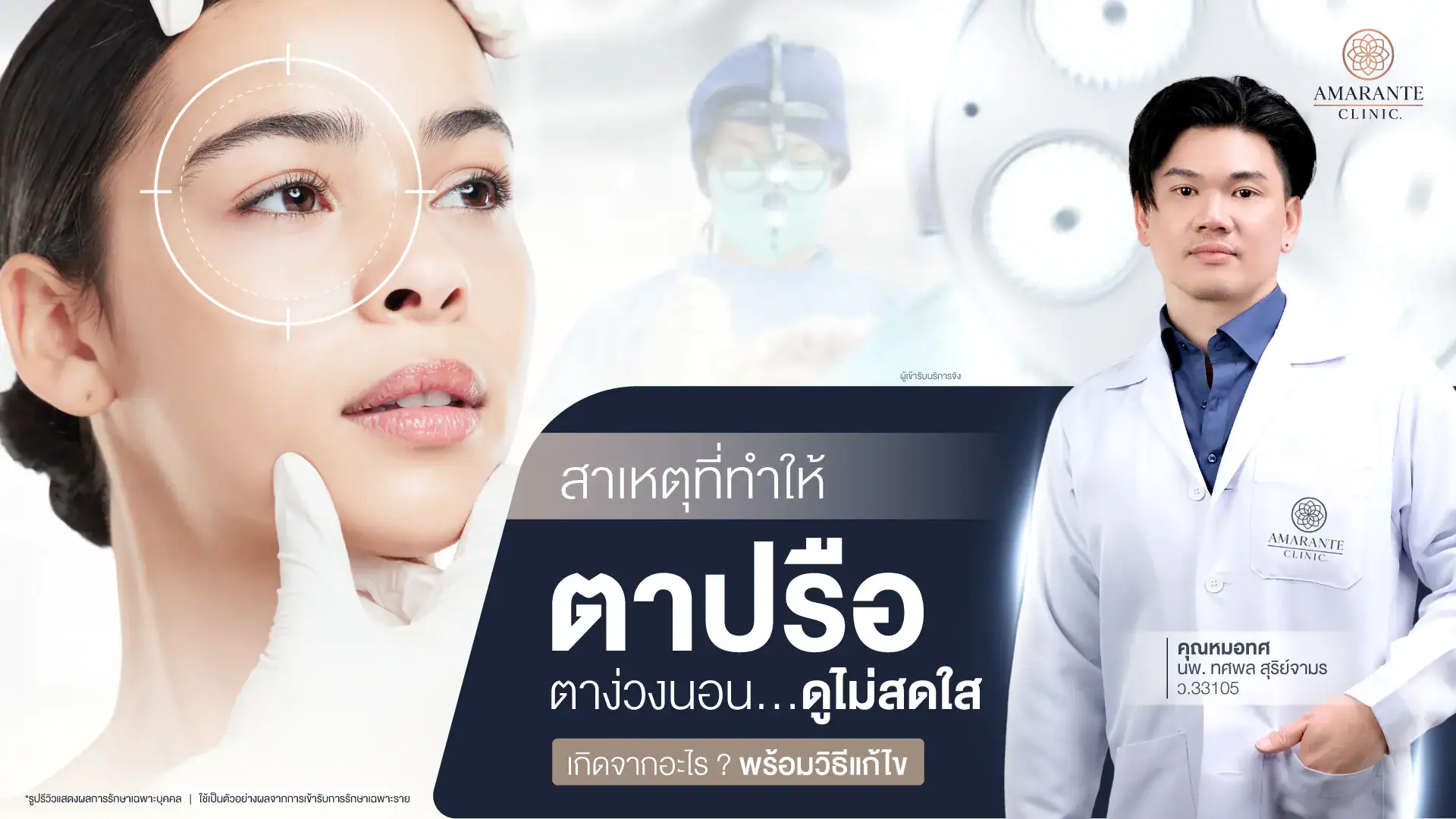 สาเหตุตาปรือ ตาง่วงนอนดูไม่สดใสเกิดจากอะไรพร้อมวิธีแก้ไข