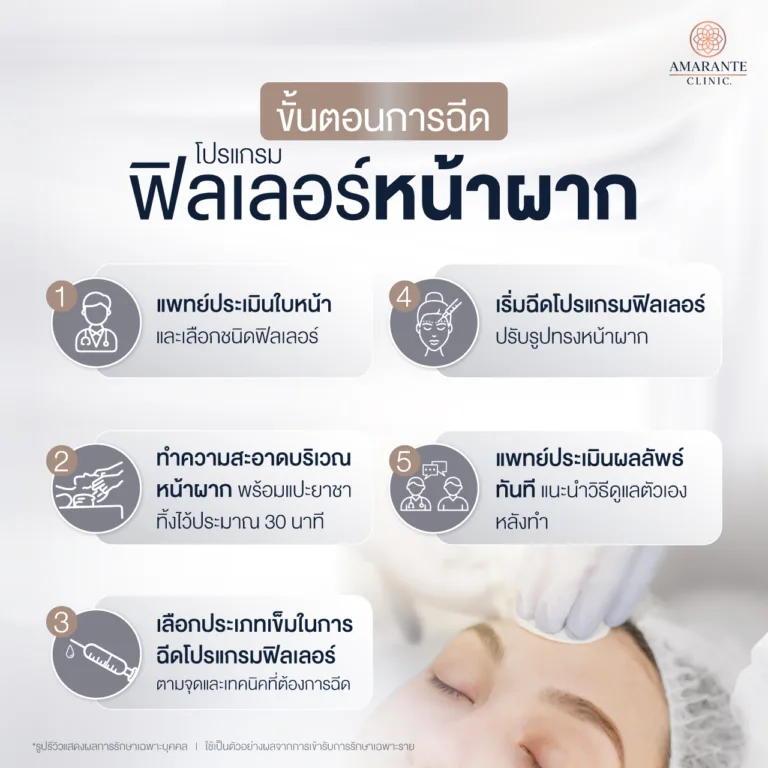 ขั้นตอนการฉีดฟิลเลอร์หน้าผาก