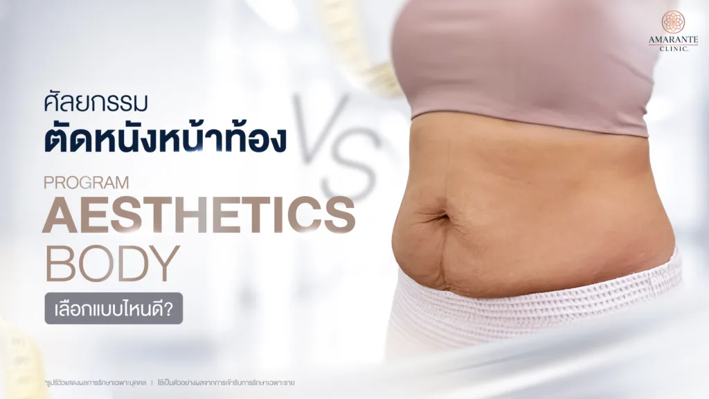 ศัลยกรรมตัดหนังหน้าท้อง vs โปรแกรม Aesthetics Body