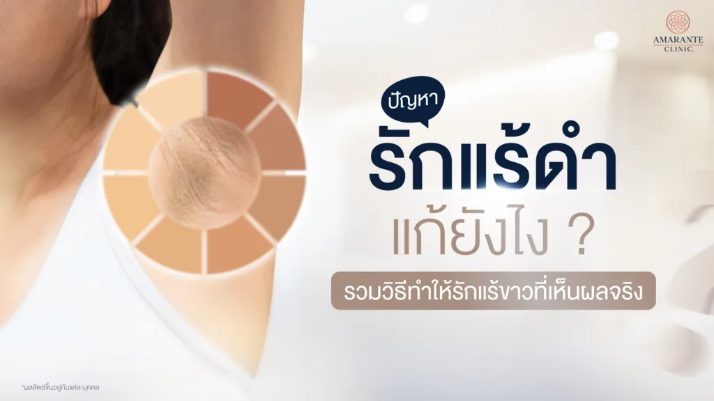 วิธีแก้รักแร้ดำ แบบธรรมชาติและแบบเร่งด่วน