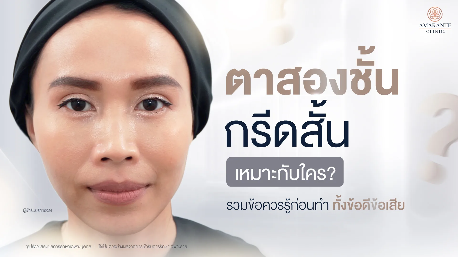 ตาสองชั้นกรีดสั้น เหมาะกับใคร ข้อดีข้อเสีย