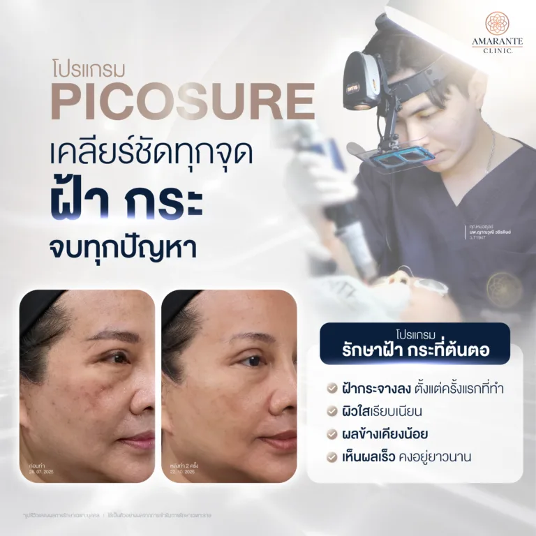 วิธีลดฝ้า กระ สำหรับคนอายุ 40-50 ปีขึ้นไปแบบเร่งด่วน