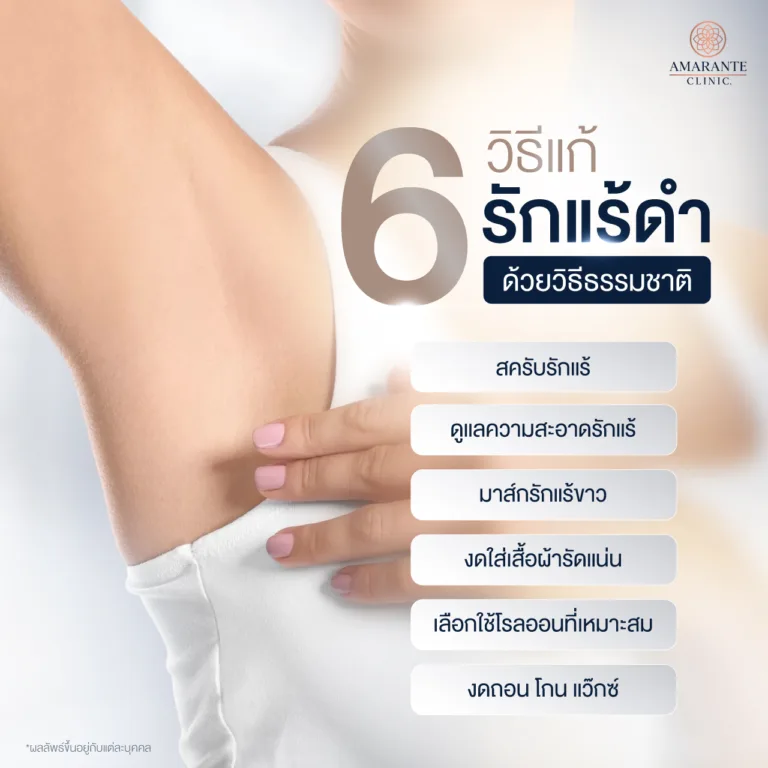 วิธีแก้รักแร้ดำด้วยตัวเองแบบธรรมชาติ