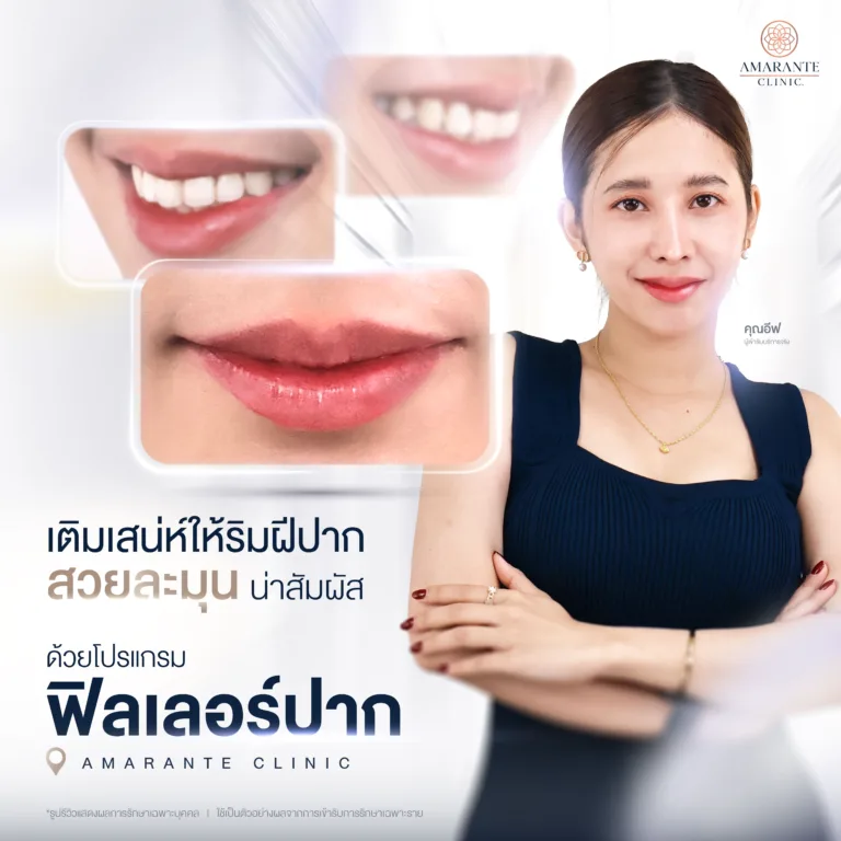 โปรแกรมฟิลเลอร์ปาก ที่ Amarante Clinic