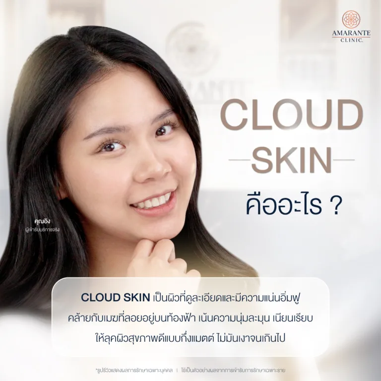Cloud Skin คืออะไร ?