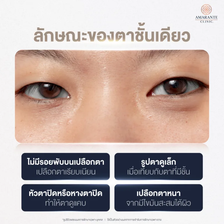 ลักษณะของตาชั้นเดียว