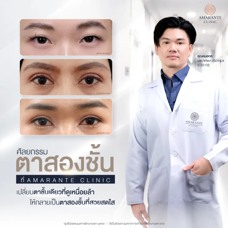 ศัลยกรรมตาสองชั้น ที่ Amarante Clinic