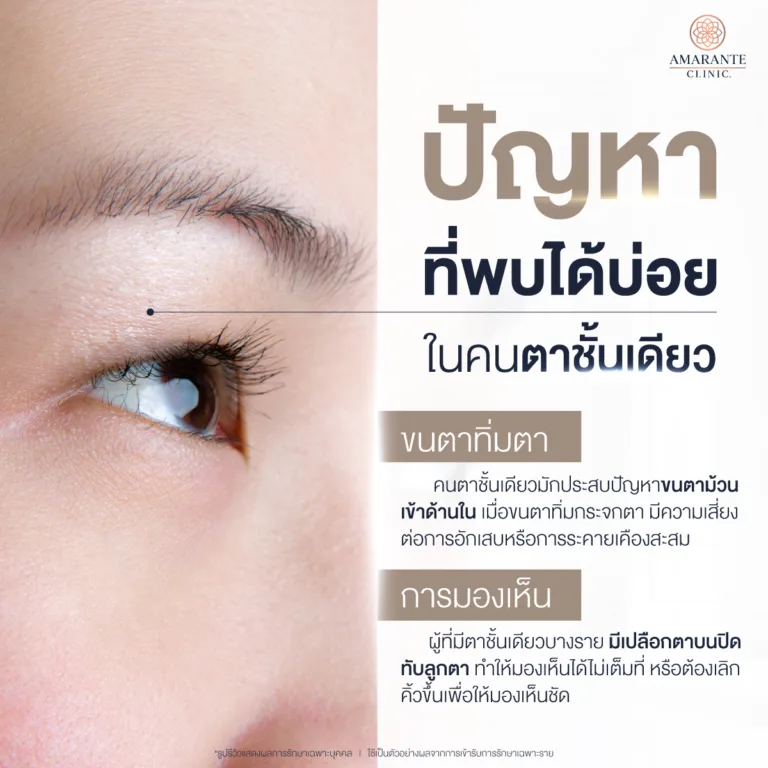 ปัญหาที่พบได้บ่อยในคนตาชั้นเดียว