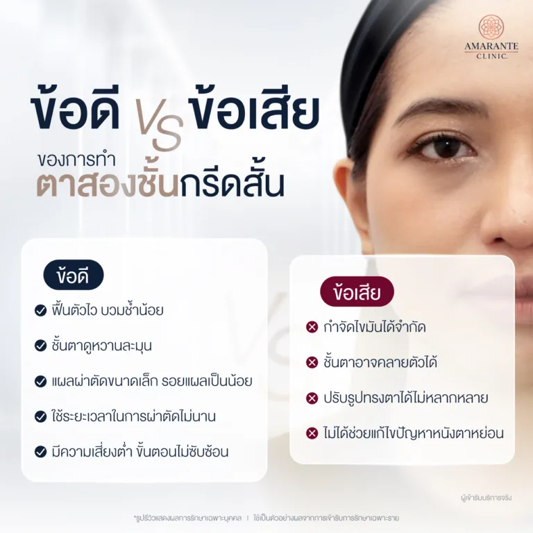 ข้อดี ข้อเสียการทำตาสองชั้นกรีดสั้น