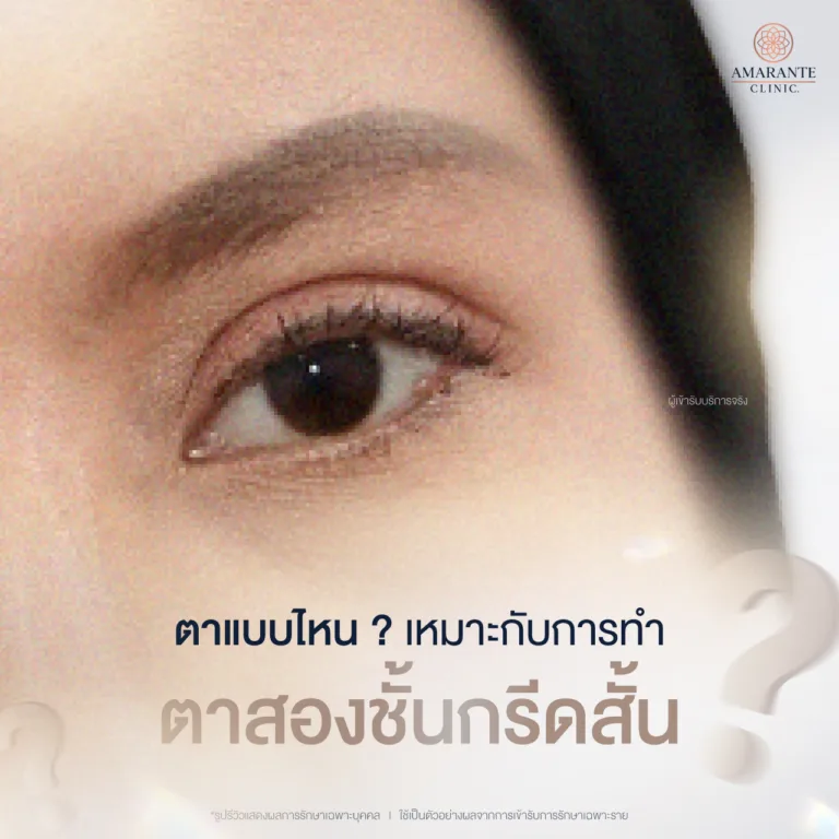 ตาแบบไหนเหมาะกับการทำตาสองชั้นกรีดสั้น