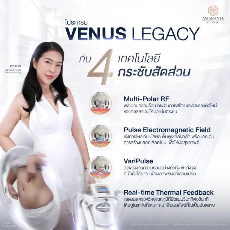 Venus Legacy ทำงานอย่างไร?