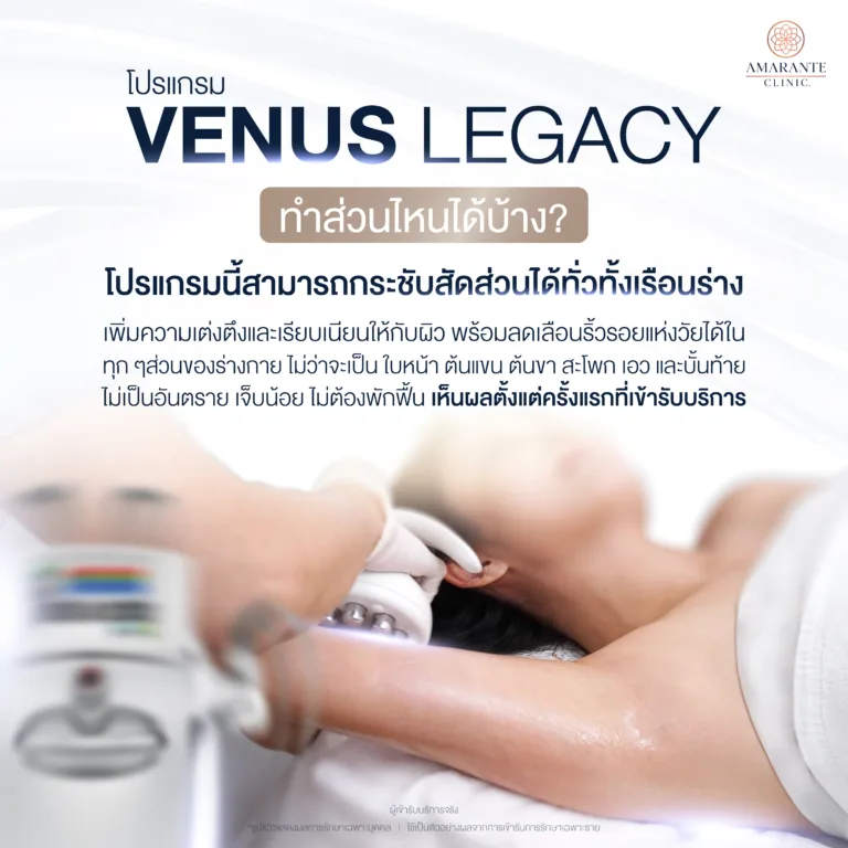 โปรแกรมนวดลดไขมัน Venus Legacy ทำตรงส่วนไหนได้บ้าง ?