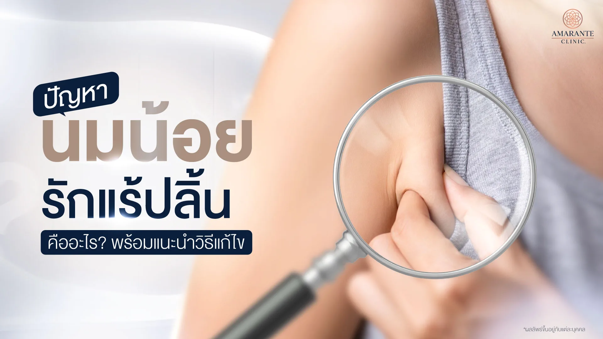 รวมวิธีแก้ปัญหา นมน้อย เนื้อใต้รักแร้ปลิ้น