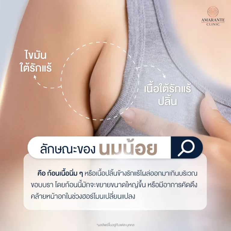 ลักษณะของ นมน้อย