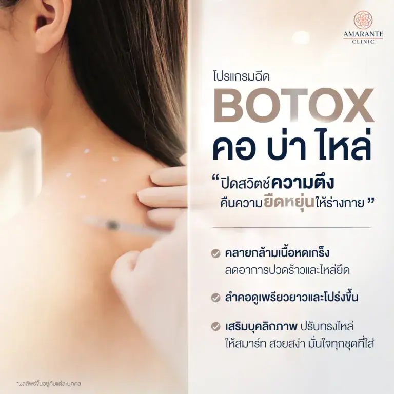 ฉีด โบท็อกคอ บ่า ไหล่ ช่วยคลายกล้ามเนื้อ ลดการปวด