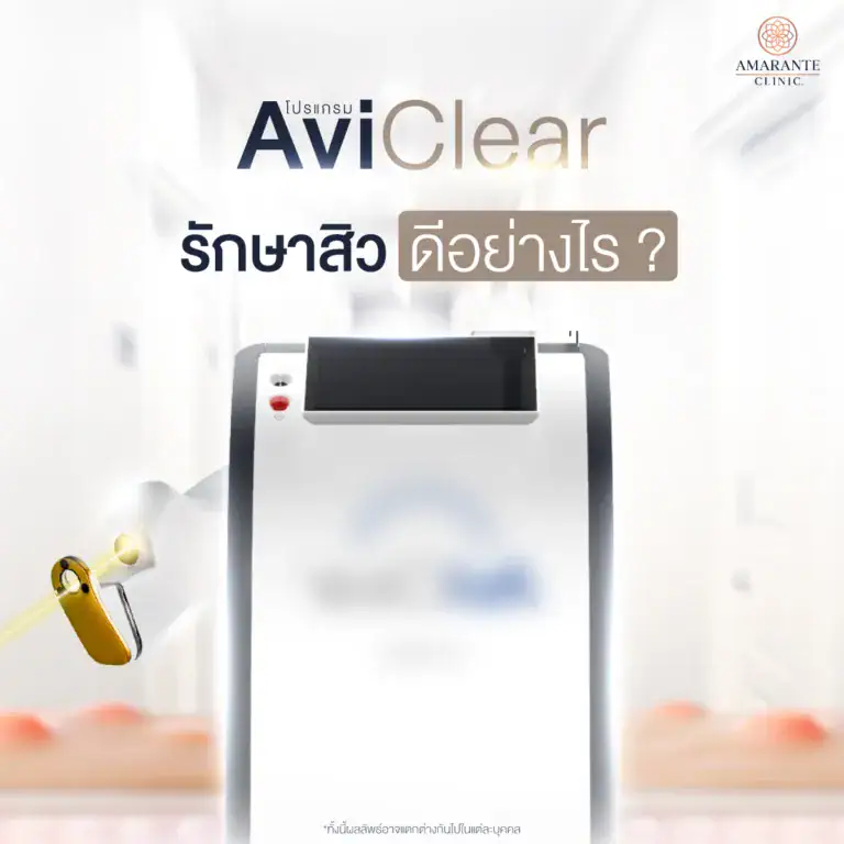 โปรแกรม AviClear รักษาสิวดีอย่างไร ?