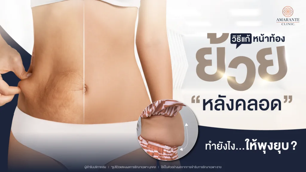 วิธีแก้หน้าท้องย้วยหลังคลอด รวมไว้ให้แล้วสำหรับคุณแม่
