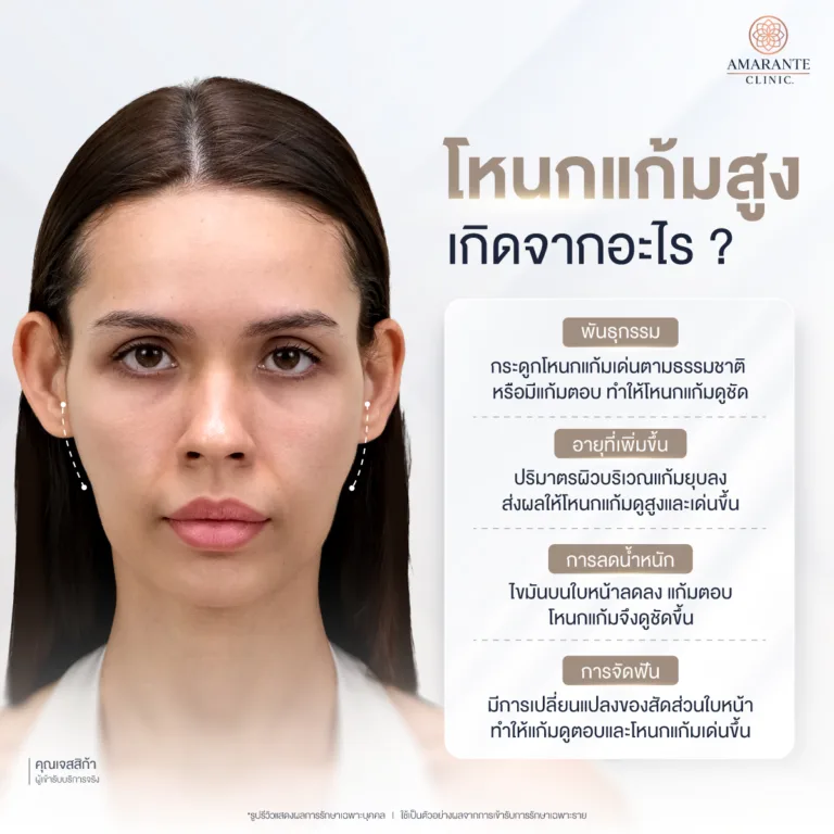 โหนกแก้มสูงเกิดจากอะไร ?