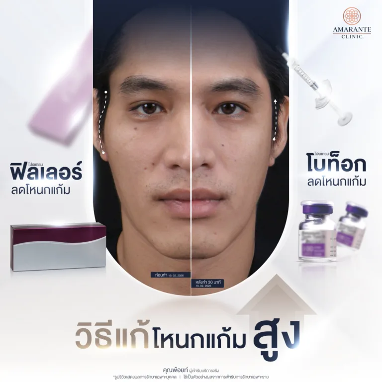 วิธีแก้โหนกแก้มสูง