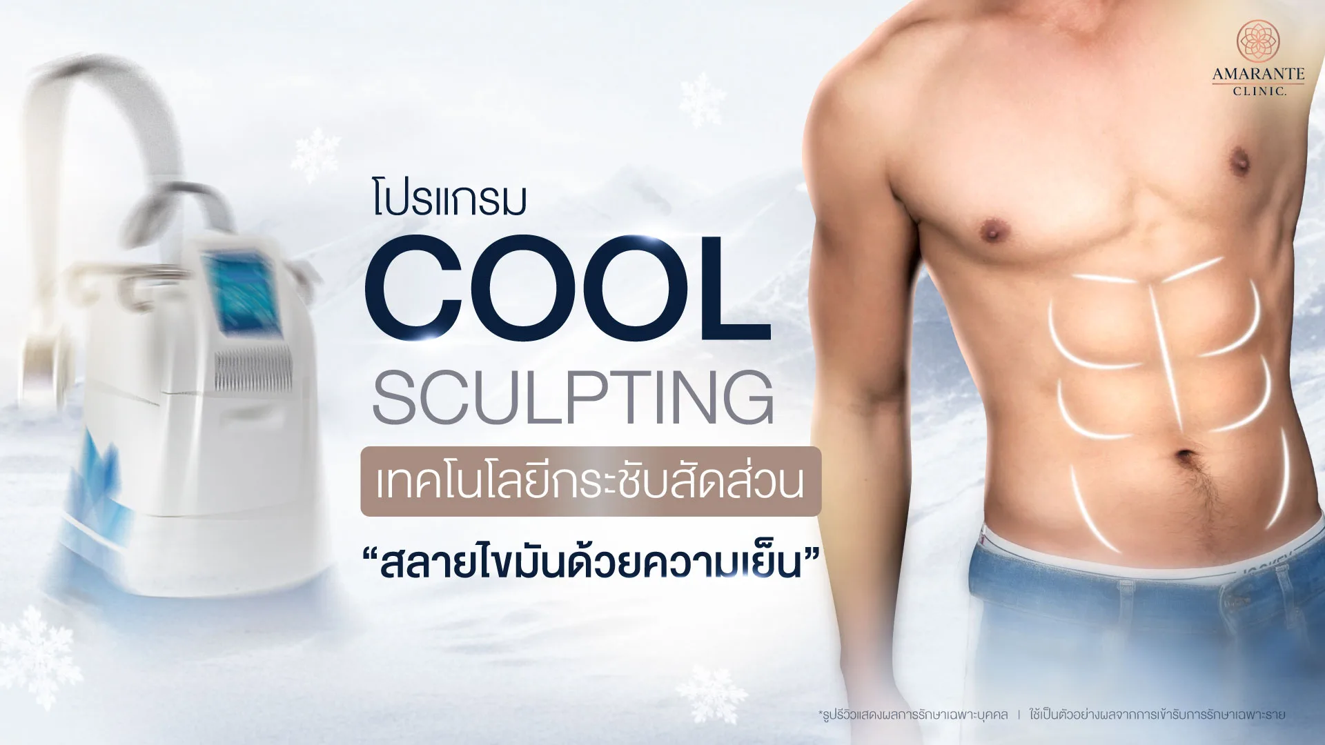 Cool Sculpting เทคโนโลยีและนวัตกรรม กระชับสัดส่วน สลายไขมันด้วยความเย็น