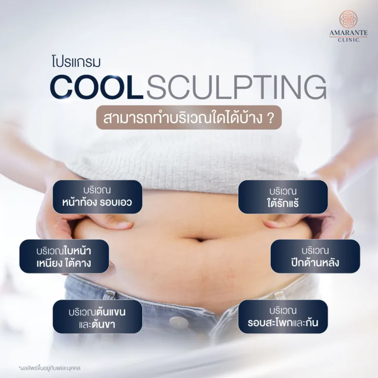 CoolSculpting สามารถทำบริเวณใดได้บ้าง ?