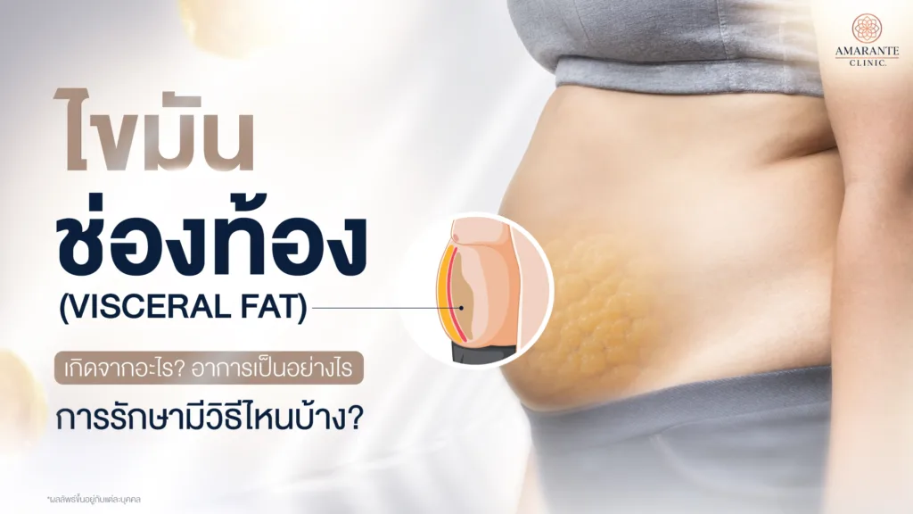 ไขมันช่องท้อง