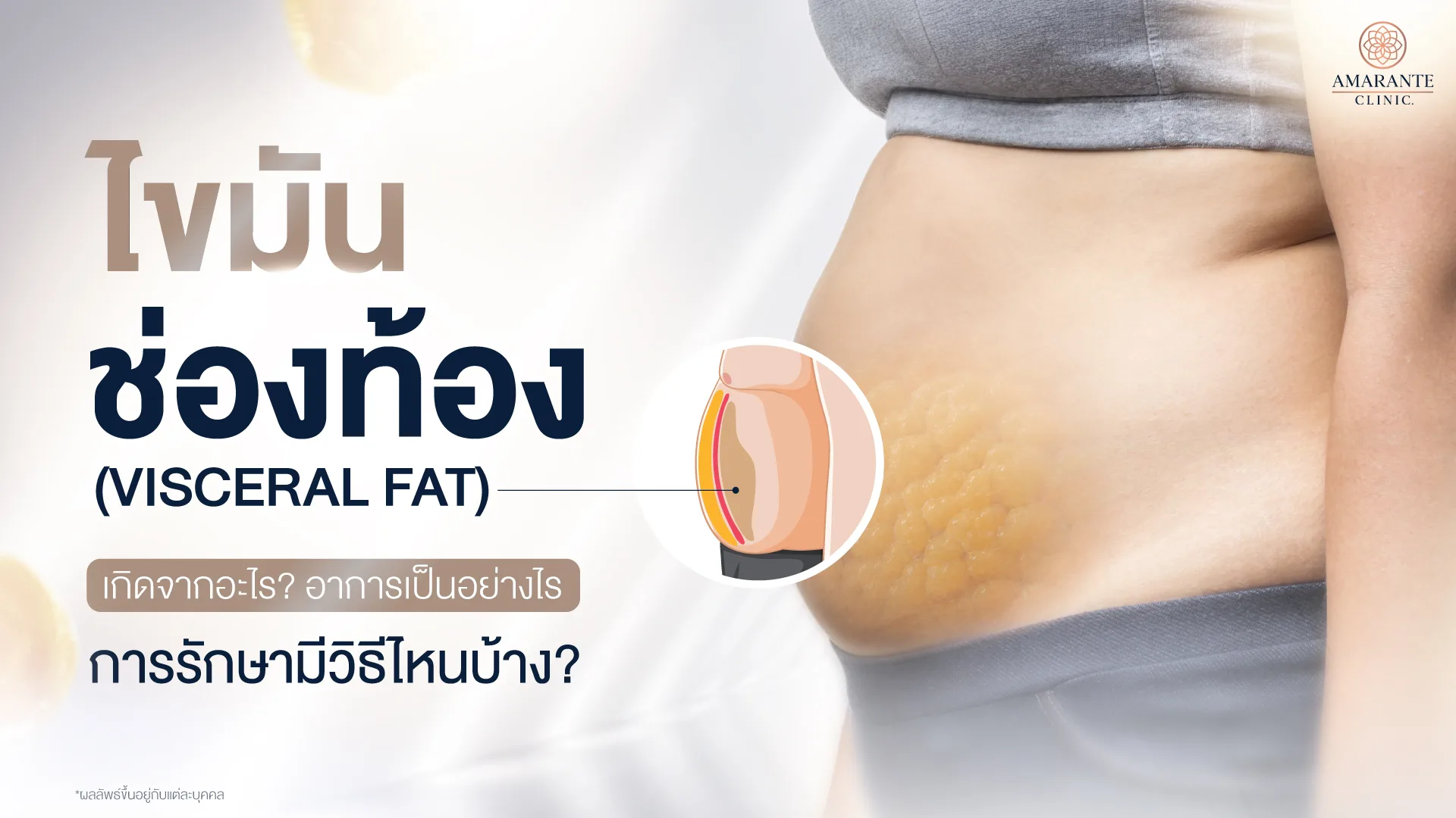ไขมันช่องท้อง
