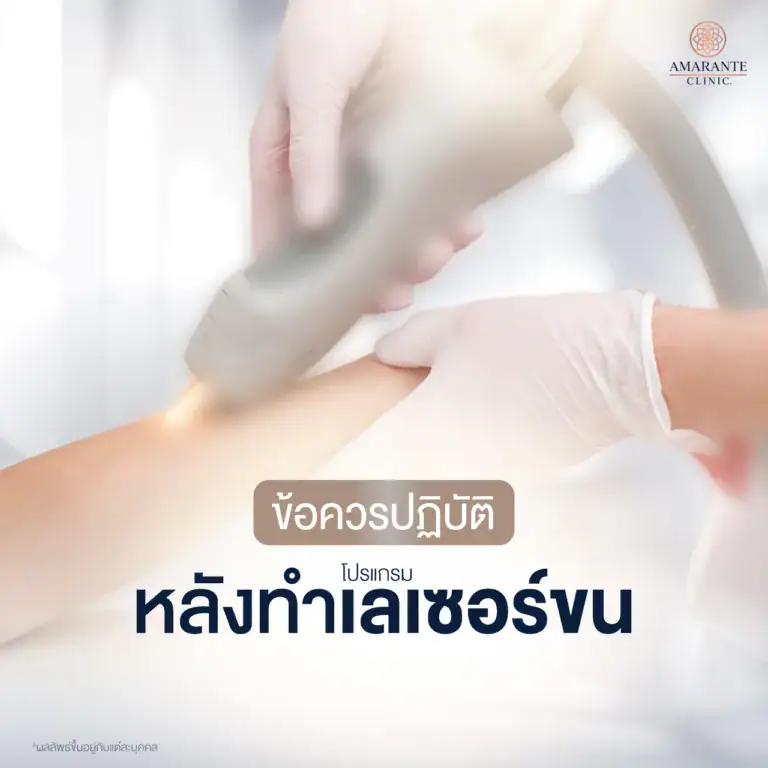 การดูแลหลังทำเลเซอร์ขน